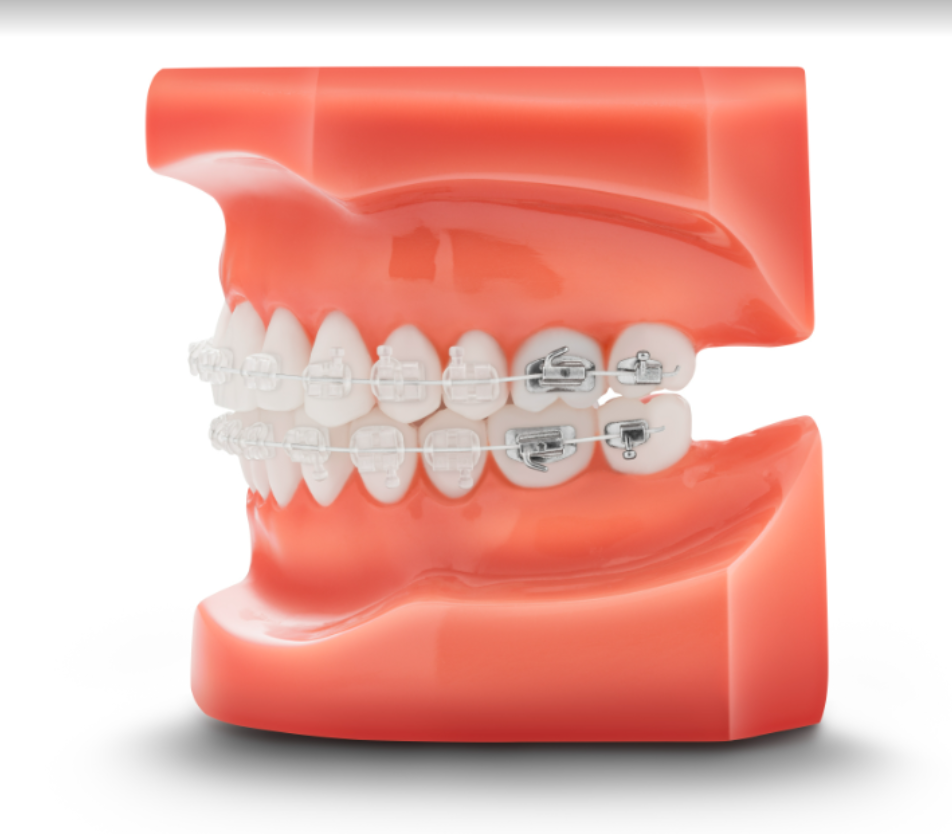 TP ortho 1