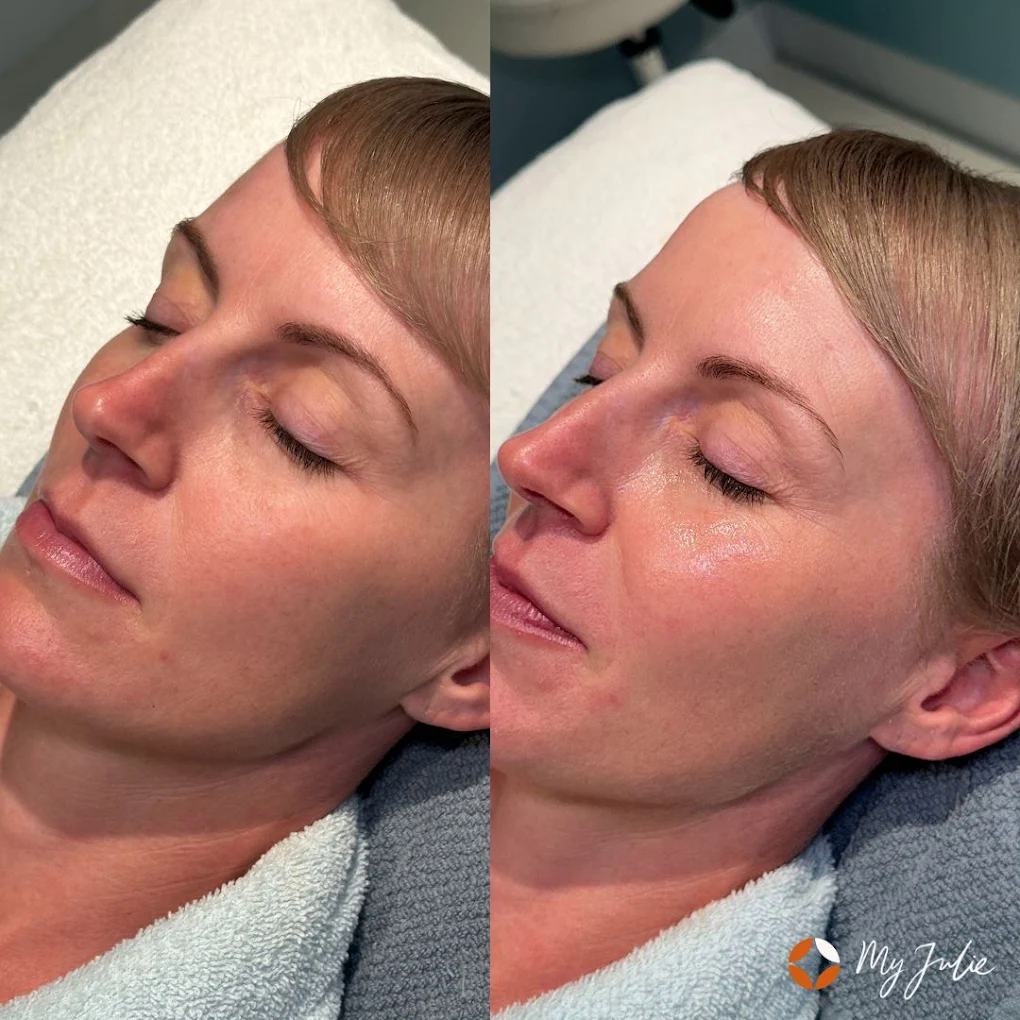 My Julie Moonee Ponds