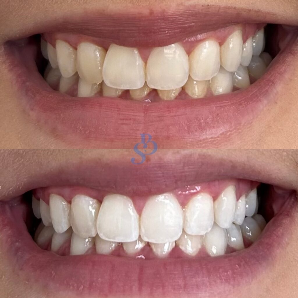 Blanche Smiles Dental Studio Moonee Ponds
